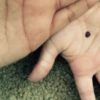 手に黒い点を書き、被害を無言で訴える「ブラックドットキャンペーン」 | Imishin.jp